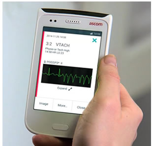 Ascom monitor paziente